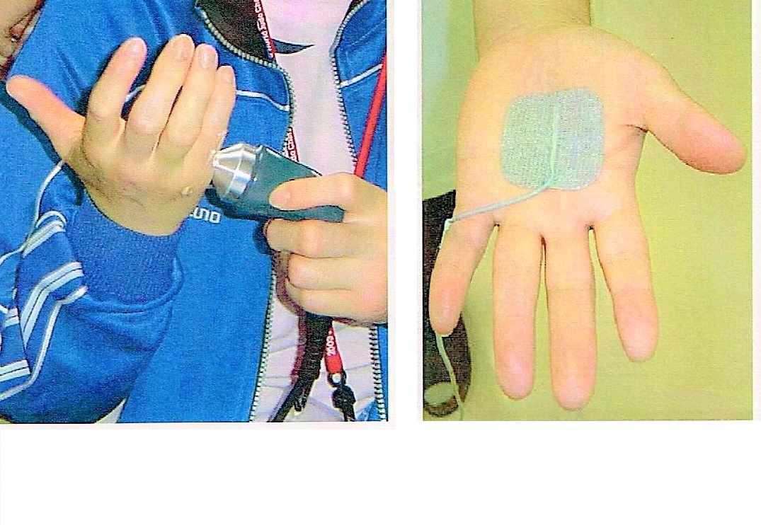 img src=”tukiyubi.jpeg” alt=”江井ヶ島でこの1台。超音波コンビネーションを使った突き指の治療”