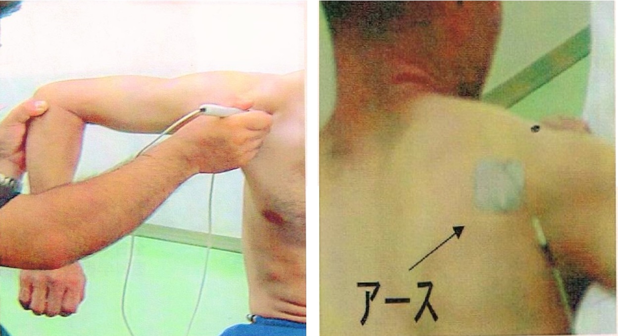 img src=”gojyu.jpeg” alt=”江井ヶ島でこの1台。超音波を使った五十肩の治療の例”